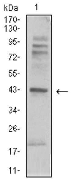 Invitrogen beta-2 Adrenergic Receptor Monoclonal Antibody (5G3B5) 100 &mu;g;