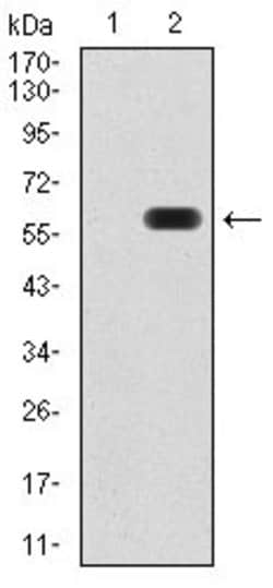 Invitrogen ATG16L1 Monoclonal Antibody (5H9A11) 100 &mu;g; Unconjugated:Antibodies,