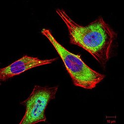 ATG5 Monoclonal Antibody (8E8G6):Antibodies, Monoclonal