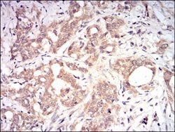 Invitrogen beta-2 Microglobulin Monoclonal Antibody (4G5A1) 100 μg;