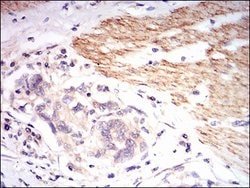 Invitrogen beta-2 Microglobulin Monoclonal Antibody (4G5A1) 100 μg;