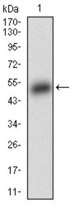 Invitrogen BAD Monoclonal Antibody (1G5B3) 100 &mu;g; Unconjugated:Antibodies,