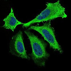 BDNF Monoclonal Antibody (3D9C5):Antibodies, Monoclonal