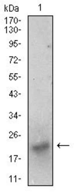 BDNF Monoclonal Antibody (3D9C5):Antibodies, Monoclonal