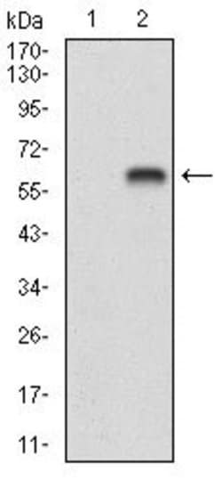 BDNF Monoclonal Antibody (3D9C5):Antibodies, Monoclonal