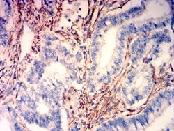 Invitrogen Caldesmon Monoclonal Antibody (3A12G1) 100 &mu;g; Unconjugated:Antibodies,