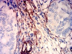 Invitrogen Caldesmon Monoclonal Antibody (3A12G1) 100 &mu;g; Unconjugated:Antibodies,