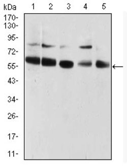 CBX2 Monoclonal Antibody (4C11B10):Antibodies, Monoclonal