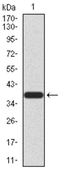 CBX2 Monoclonal Antibody (4C11B10):Antibodies, Monoclonal