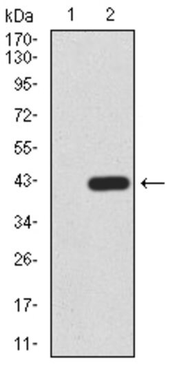 CBX2 Monoclonal Antibody (4C11B10):Antibodies, Monoclonal