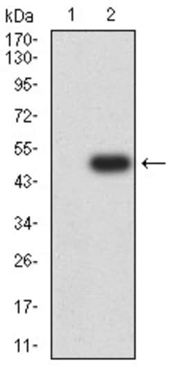 SEMA7A Monoclonal Antibody (1D5G8):Antibodies, Monoclonal