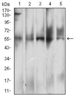 Invitrogen CD299 (DC-SIGN/L) Monoclonal Antibody (8A1B3) 100 &mu;g; Unconjugated:Antibodies,
