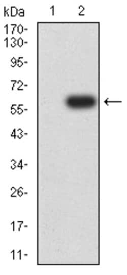 Invitrogen FCRL2 Monoclonal Antibody (7B12A3) 100 &mu;g; Unconjugated:Antibodies,