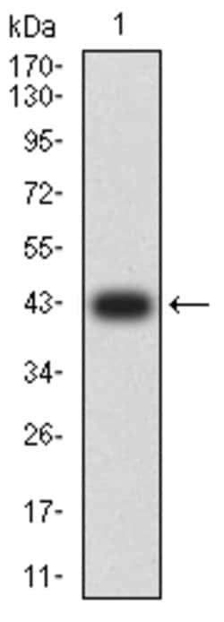 Invitrogen CD307e (FcRL5) Monoclonal Antibody (2A10H7) 100 &mu;g; Unconjugated:Antibodies,