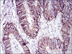 Invitrogen CDH17 Monoclonal Antibody (7D10E1) 100 &mu;g; Unconjugated:Antibodies,