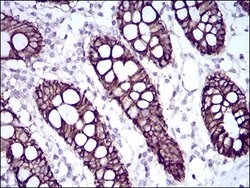 Invitrogen CDH17 Monoclonal Antibody (7D10E1) 100 &mu;g; Unconjugated:Antibodies,