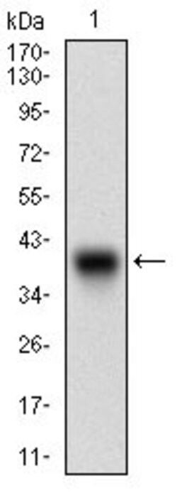 Invitrogen CDH17 Monoclonal Antibody (7D10E1) 100 &mu;g; Unconjugated:Antibodies,