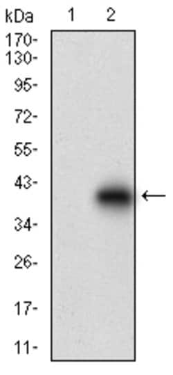 Invitrogen CDH17 Monoclonal Antibody (7D10E1) 100 &mu;g; Unconjugated:Antibodies,