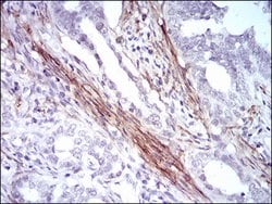 Invitrogen Calponin 1 Monoclonal Antibody (1H5B5) 100 &mu;g; Unconjugated:Antibodies,