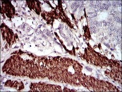 Invitrogen Calponin 1 Monoclonal Antibody (1H5B5) 100 &mu;g; Unconjugated:Antibodies,