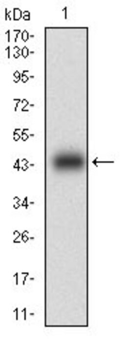 Invitrogen Calponin 1 Monoclonal Antibody (1H5B5) 100 &mu;g; Unconjugated:Antibodies,