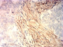 Invitrogen Calponin 3 Monoclonal Antibody (5E4E4) 100 &mu;g; Unconjugated:Antibodies,