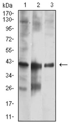 Invitrogen Calponin 3 Monoclonal Antibody (5E4E4) 100 &mu;g; Unconjugated:Antibodies,