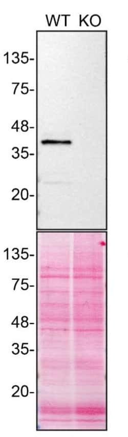 Invitrogen Calponin 3 Monoclonal Antibody (5E4E4) 100 &mu;g; Unconjugated:Antibodies,