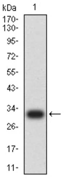 Invitrogen COL1A2 Monoclonal Antibody (4D1A7) 100 &mu;g; Unconjugated:Antibodies,