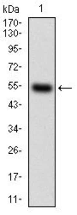 Invitrogen CSF1R Monoclonal Antibody (6B9B9) 100 &mu;g; Unconjugated:Antibodies,