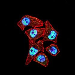 Invitrogen CTNNBL1 Monoclonal Antibody (3C7F9) 100 &mu;g; Unconjugated:Antibodies,