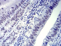 Invitrogen CTNNBL1 Monoclonal Antibody (3C7F9) 100 &mu;g; Unconjugated:Antibodies,