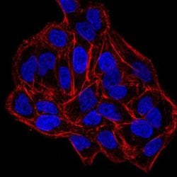 DNMT3B Monoclonal Antibody (4D1A2E5):Antibodies, Monoclonal