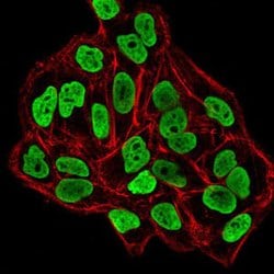 DNMT3B Monoclonal Antibody (4D1A2E5):Antibodies, Monoclonal