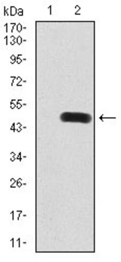 DNMT3B Monoclonal Antibody (4D1A2E5):Antibodies, Monoclonal