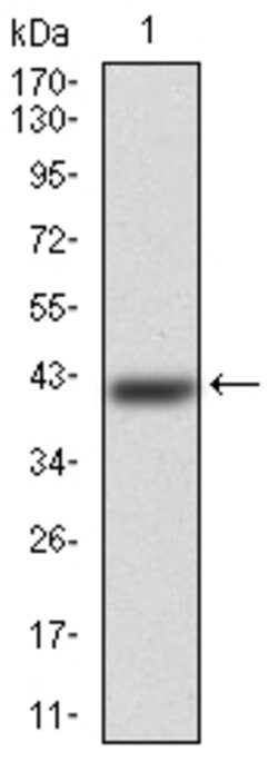 ERCC1 Monoclonal Antibody (1E5B3):Anticuerpos