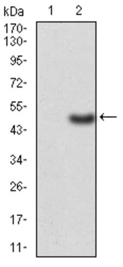 ERCC1 Monoclonal Antibody (1E5B3):Anticuerpos