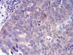Invitrogen FGFR3 Monoclonal Antibody (2H10B4) 100 &mu;g; Unconjugated:Antibodies,