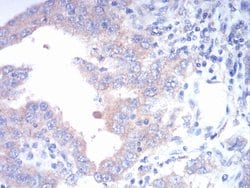 Invitrogen FGFR3 Monoclonal Antibody (2H10B4) 100 &mu;g; Unconjugated:Antibodies,