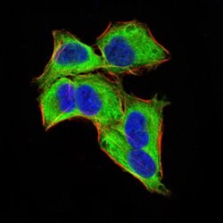 Invitrogen GLI1 Monoclonal Antibody (1B9F8) 100 &mu;g; Unconjugated:Antibodies,