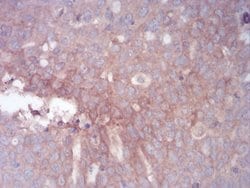 Invitrogen GLI1 Monoclonal Antibody (1B9F8) 100 &mu;g; Unconjugated:Antibodies,