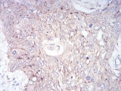 Invitrogen GLI1 Monoclonal Antibody (1B9F8) 100 &mu;g; Unconjugated:Antibodies,