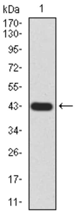 Invitrogen GLI1 Monoclonal Antibody (1B9F8) 100 &mu;g; Unconjugated:Antibodies,