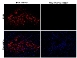 Invitrogen Glutamine Synthetase Monoclonal Antibody (2D11A2) 100 &mu;g;