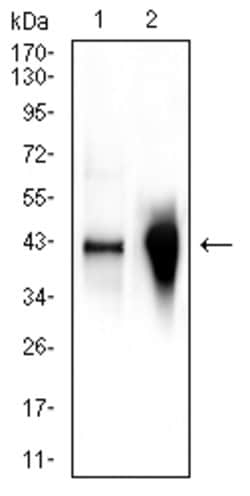 Invitrogen Glutamine Synthetase Monoclonal Antibody (2D11A2) 100 &mu;g;