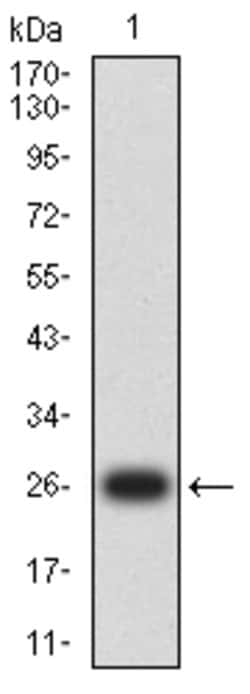 Invitrogen GSTP1 Monoclonal Antibody (1A7B5) 100 &mu;g; Unconjugated:Antibodies,