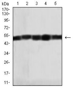 HAS1 Monoclonal Antibody (5C9D6):Antibodies, Monoclonal