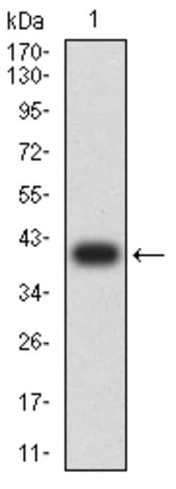 HAS1 Monoclonal Antibody (5C9D6):Antibodies, Monoclonal