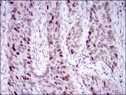 Invitrogen HDAC10 Monoclonal Antibody (3B6B8) 100 &mu;g; Unconjugated:Antibodies,