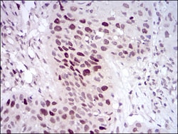 Invitrogen HDAC10 Monoclonal Antibody (3B6B8) 100 &mu;g; Unconjugated:Antibodies,
